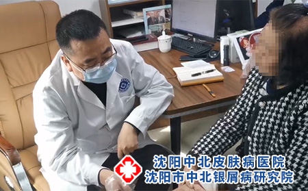 沈阳看银屑病好的-沈阳市中北银屑病研究院-沈阳哪有专治银屑病