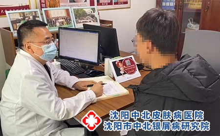 沈阳市中北银屑病-沈阳中北银屑病研究院-沈阳银屑病去哪儿治