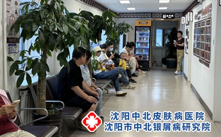 沈阳银屑病专科面诊 - 沈阳中北医院 沈阳银屑病专科面诊 - 沈阳中北医院
