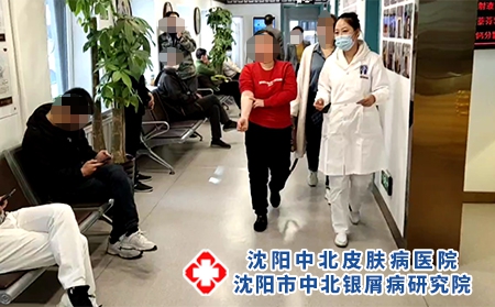 牛皮癣住院治疗环境 - 沈阳中北医院 牛皮癣住院治疗环境 - 沈阳中北医院