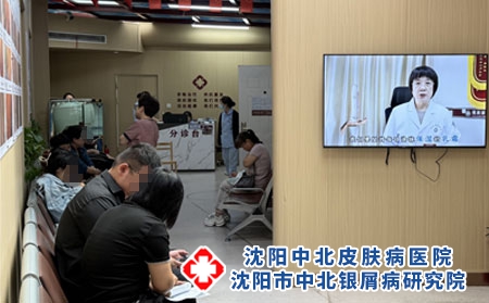 沈阳顽固性牛皮癣诊疗 - 沈阳中北医院 沈阳顽固性牛皮癣诊疗 - 沈阳中北医院
