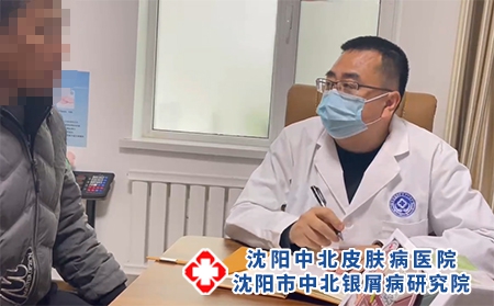 辽宁牛皮癣权威专家 - 沈阳中北医院 辽宁牛皮癣权威专家 - 沈阳中北医院