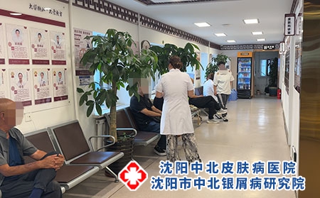 沈阳孙金奎看银屑病 - 沈阳中北医院 沈阳孙金奎看银屑病 - 沈阳中北医院