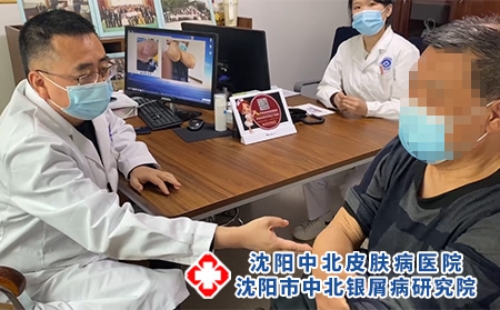 沈阳治牛皮癣最好医生 - 沈阳中北医院 沈阳治牛皮癣最好医生 - 沈阳中北医院
