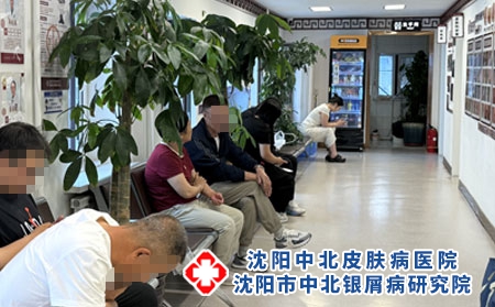 沈阳中医治银屑病场景 - 沈阳中北医院 沈阳中医治银屑病场景 - 沈阳中北医院