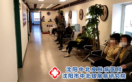 沈阳银屑病专家门诊 - 沈阳中北医院