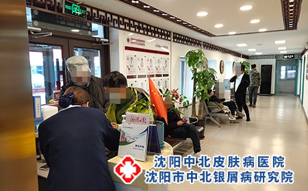 辽宁牛皮癣医院排名 - 沈阳中北医院 辽宁牛皮癣医院排名 - 沈阳中北医院