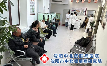 辽宁牛皮癣重症皮损诊疗医院-沈阳中北医院 辽宁牛皮癣重症皮损诊疗医院-沈阳中北医院
