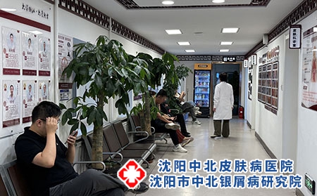 辽宁牛皮癣生物制剂治疗医院-沈阳中北医院