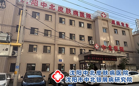 沈阳牛皮癣专科正规就诊医院---沈阳中北医院