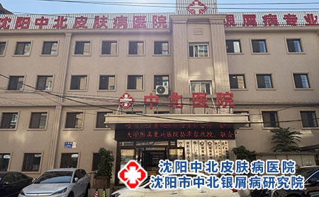 辽宁专治银屑病皮肤病医院排名---沈阳中北医院