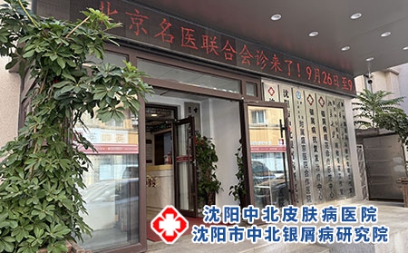 辽宁本地银屑病专业诊疗医院推荐---沈阳中北医院 辽宁本地银屑病专业诊疗医院推荐---沈阳中北医院