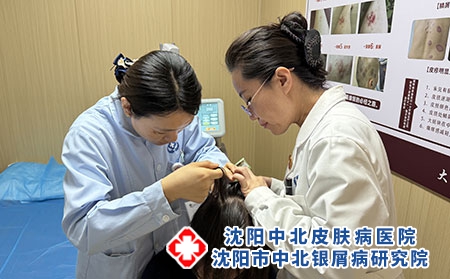 辽宁皮肤病医院郎院长-沈阳中北医院 辽宁皮肤病医院郎院长-沈阳中北医院