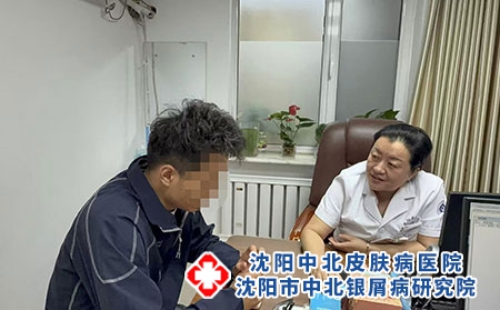 沈阳牛皮癣刘艳丽分型诊疗优质专科榜单---沈阳中北医院 沈阳牛皮癣刘艳丽分型诊疗优质专科榜单---沈阳中北医院