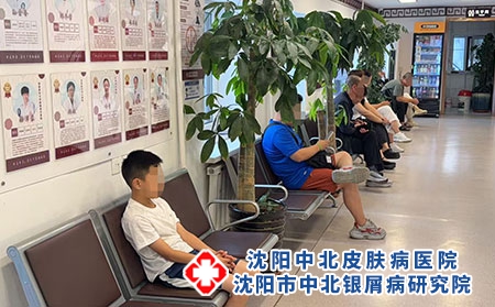 沈阳银屑病规范化诊疗专科医院-沈阳中北医院