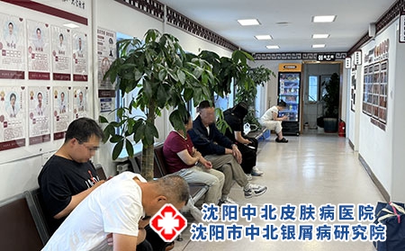 辽宁牛皮癣中西医结合治疗-沈阳中北医院 辽宁牛皮癣中西医结合治疗-沈阳中北医院