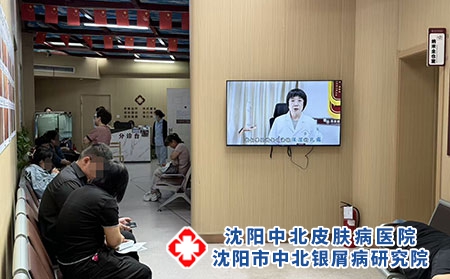 辽宁专治牛皮癣专科医院-沈阳中北医院 辽宁专治牛皮癣专科医院-沈阳中北医院