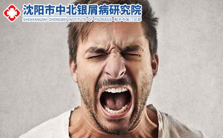 男生得银屑病会遗传给下一代吗