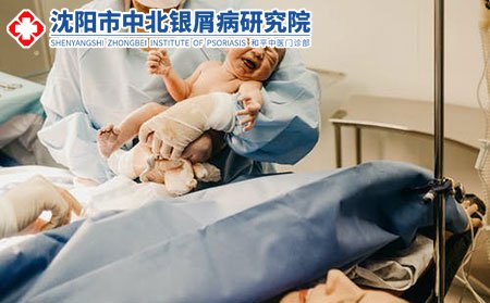 牛皮癣会不会遗传