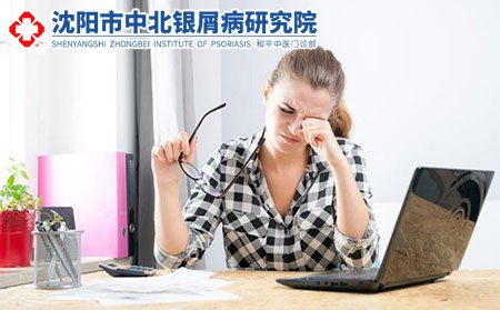 银屑病的预防