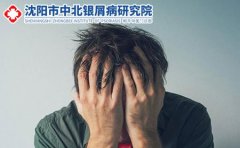 牛皮癣能不能治好