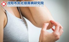 生活中哪种东西容易引起皮肤过敏