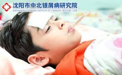 牛皮癣什么原因引起的