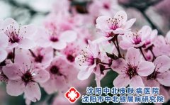 银屑病冬季病情会加重吗?是季节性疾病吗?