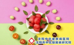 平时如何预防银屑病