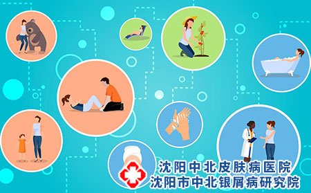 牛皮癣为什么会复发,引起牛皮癣的原因,牛皮癣原因