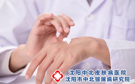 银屑病护理的四个小常识是什么