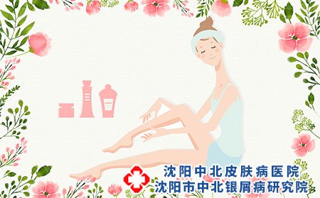 脂溢性皮炎引起原因如何预防脂溢性皮炎