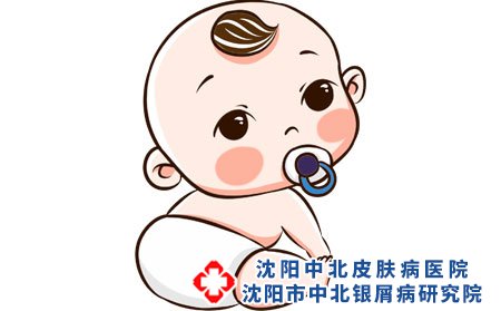 宝宝湿疹应该注意什么?
