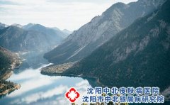 湿疹吃什么食物好的快