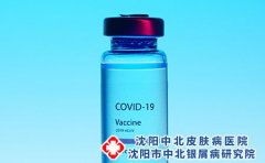 湿疹吃什么中药