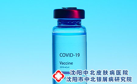 湿疹吃什么中药