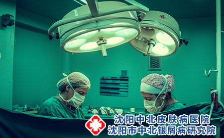 脂溢性皮炎的治疗方法有哪些?如何预防?
