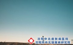 神经性皮炎的治疗方法有哪些?饮食注意什么?