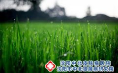 皮炎如何治