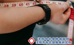 特应性皮炎要注意哪些?