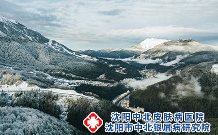 荨麻疹日常护理应该注意些什么?
