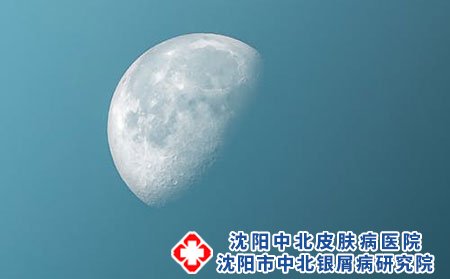 荨麻疹多久能好?反复发作怎么办?