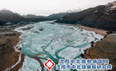 荨麻疹是什么?有多少种?中医辨证是什么?