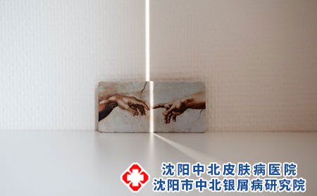 诱发荨麻疹的原因有哪些?