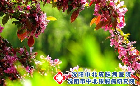 什么是荨麻疹?得了荨麻疹应该怎么办?