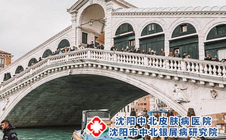 什么是荨麻疹?得了荨麻疹应该怎么办?