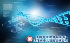 皮炎的早期症状有哪些?头部脂溢性皮炎病因?