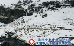 患了过敏性皮炎应该怎么办?如何日常护理?