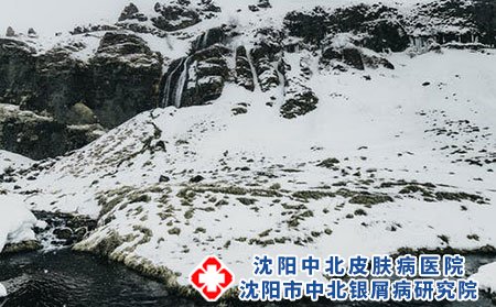 患了过敏性皮炎应该怎么办?如何日常护理?