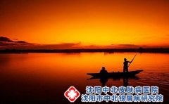 脂溢性皮炎吃什么好?应该如何保健?